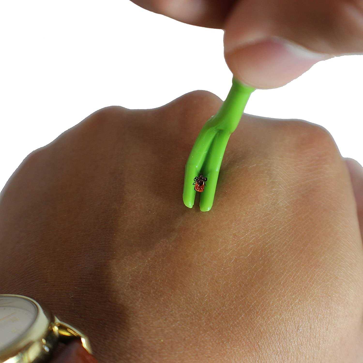 Alternative view of TickCheck Tick Remover Value 3 Pack Tick Remover Tools + Tick Identification Card